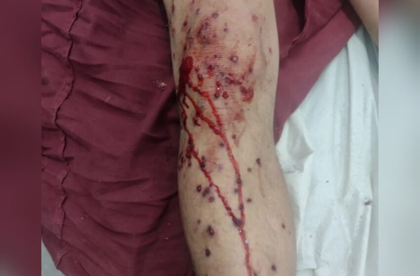  Homem é preso após agredir esposa e enteada na área rural de FRG